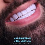 نمونه کار دندان در تهران
